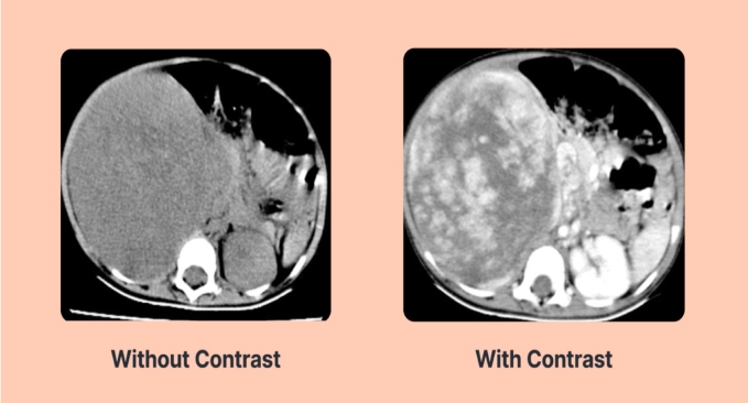 Overview of Computed Tomography