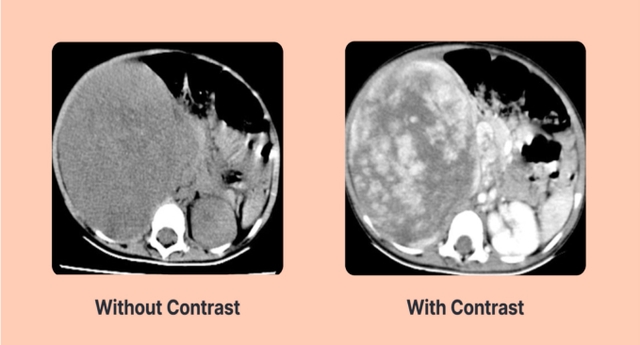 Radiologic Technologist Continuing Education | ASRT®, ARRT® CE