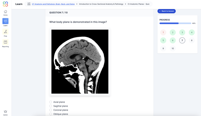 Quiz question asking "What body plane is demonstrated in this image?" with a CT scan of the brain in sagittal view. Multiple-choice options below include axial, sagittal, coronal, and oblique planes.