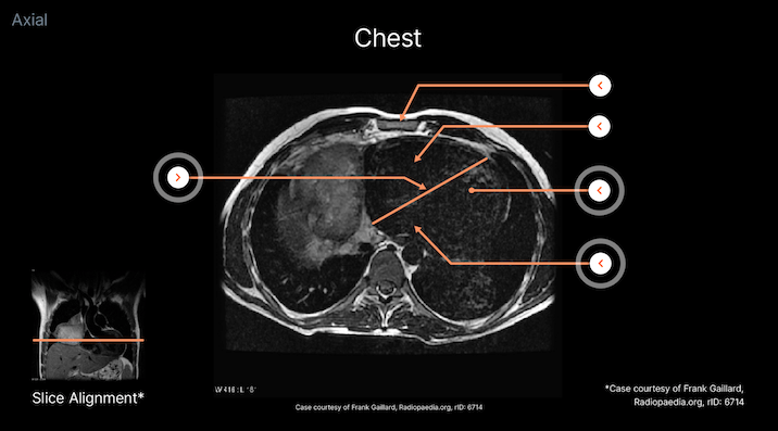 MRI_interactive_image